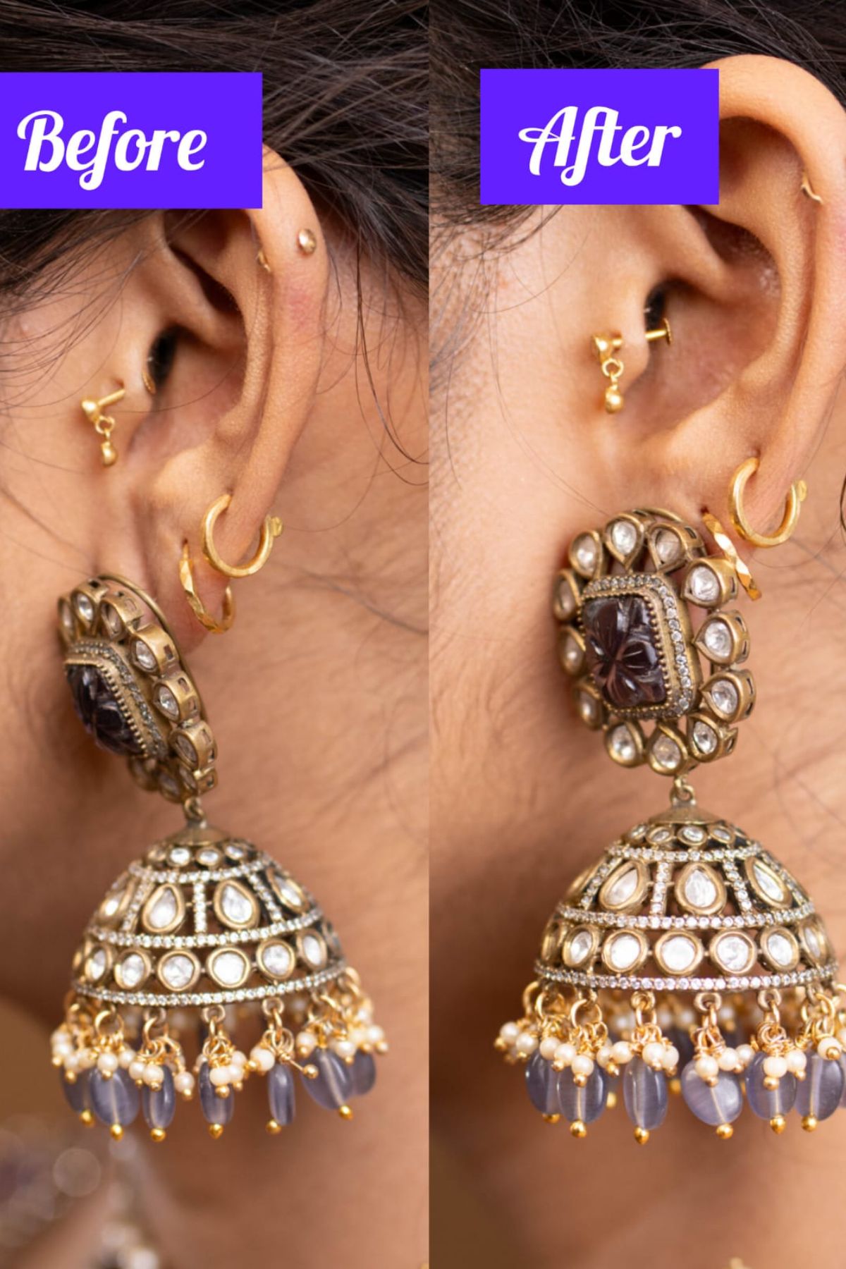WhatsApp-Image-2025-03-17-at-6.34.16-PM-2.jpeg Ear Lift Invisible Patches - Image 1